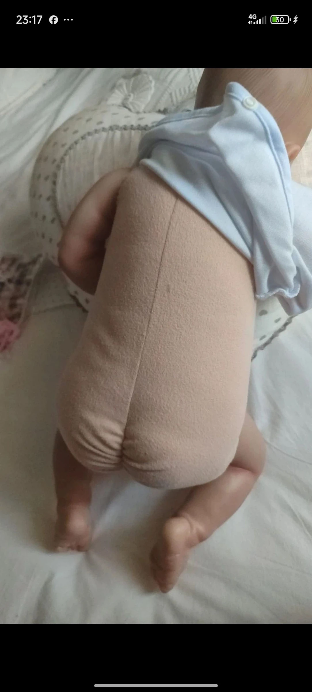 Bebe réanimé – photo 3